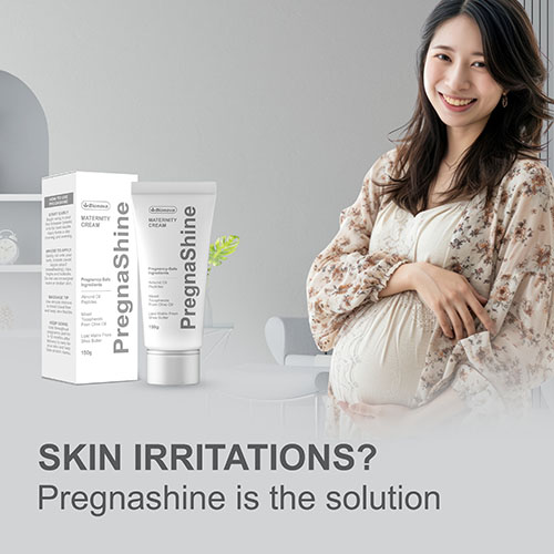 Embrace Your Skin: Stretch Mark Care